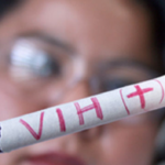 77 mil pacientes con VIH se quedan sin tratamiento en Venezuela