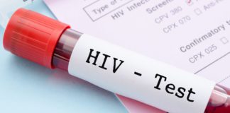 Virus del sida se propaga rápidamente en la comunidad indígena warao