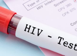 Virus del sida se propaga rápidamente en la comunidad indígena warao