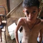 Desnutrición en Venezuela aumentó a más del doble en 2017