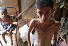 Desnutrición en Venezuela aumentó a más del doble en 2017