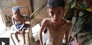 Desnutrición en Venezuela aumentó a más del doble en 2017