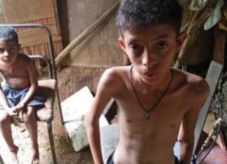 Desnutrición en Venezuela aumentó a más del doble en 2017