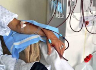 Codevida: Insumos de diálisis anunciados por MinSalud alcanzan solo para cuatro días