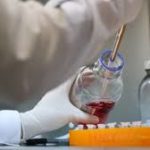 La OPS recomienda a Venezuela acciones urgentes ante sarampión y difteria