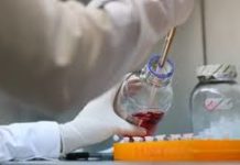 La OPS recomienda a Venezuela acciones urgentes ante sarampión y difteria