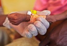 70% de población en Venezuela presenta desnutrición