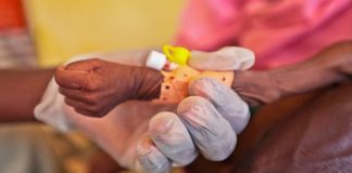 70% de población en Venezuela presenta desnutrición