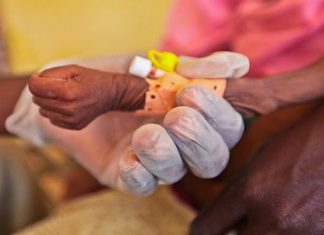 70% de población en Venezuela presenta desnutrición