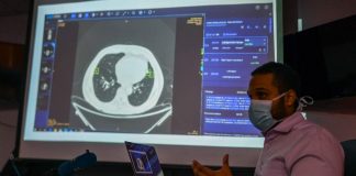 Panamá usa equipo chino de inteligencia artificial para detección de coronavirus