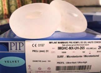 Tribunal francés confirma indemnizaciones a víctimas de implantes mamarios PIP